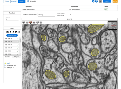 Automated Segmentation of Mitochondria with Deep Block