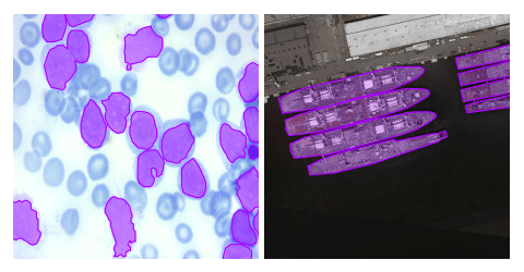 Image segmentation in micrograph and remote sensing