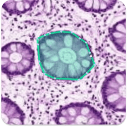 Deep Block_Digital Pathology_Photomicrograph analysis_webo