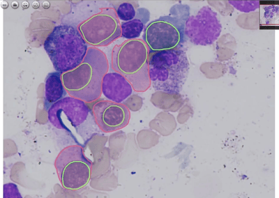 Cytoplasm Segmentation in High-Resolution Microscopy with Deep Block