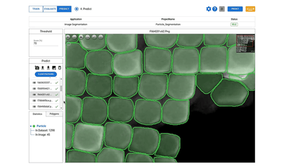 Particle Segmentation in Electron Microscopy: Revealing the Unseen