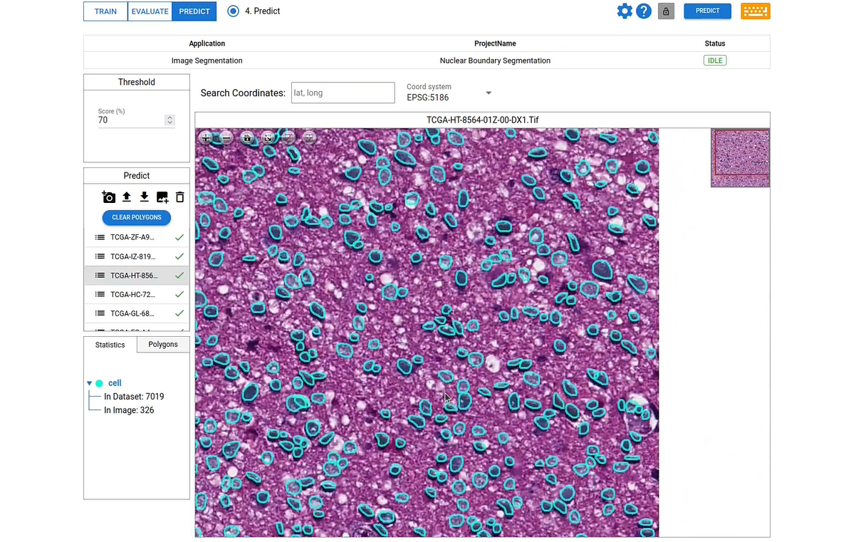 Cell Nuclei Segmentation with DeepBlock.net