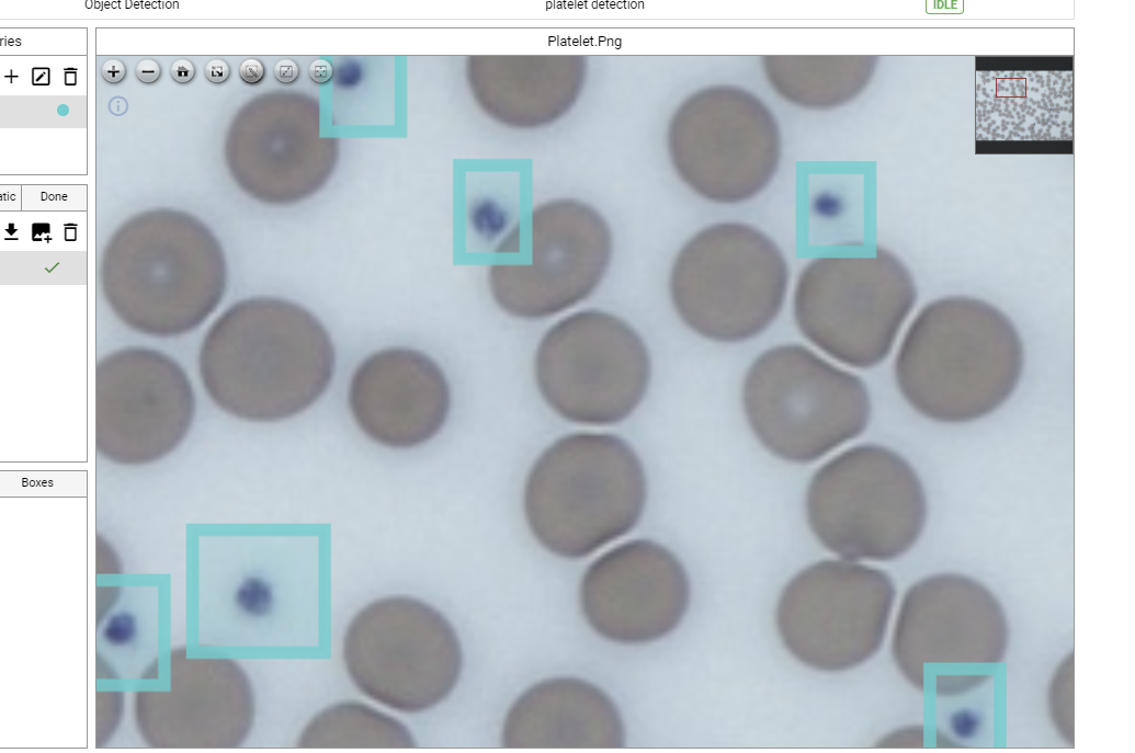 platelet detection and blob detection